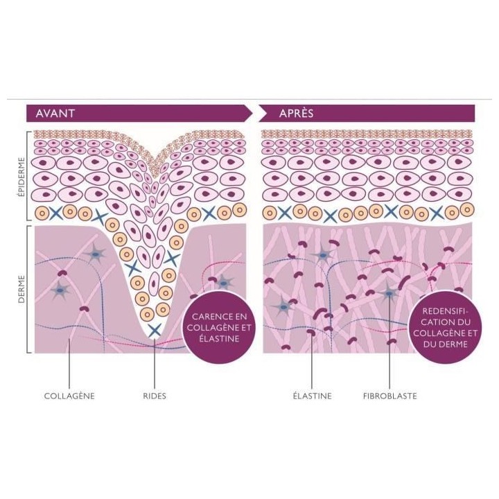 Réductions des rides et raffermissement du visage - SILK'N Facetite E