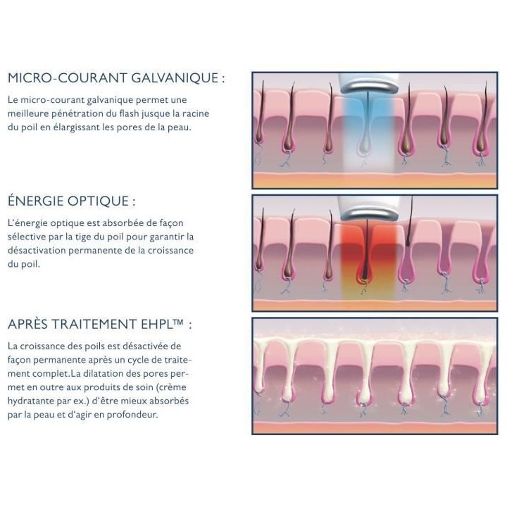 Epilateur Lumiere pulsée Infinity SILK'N - INF1PE1001 - 400,000flash