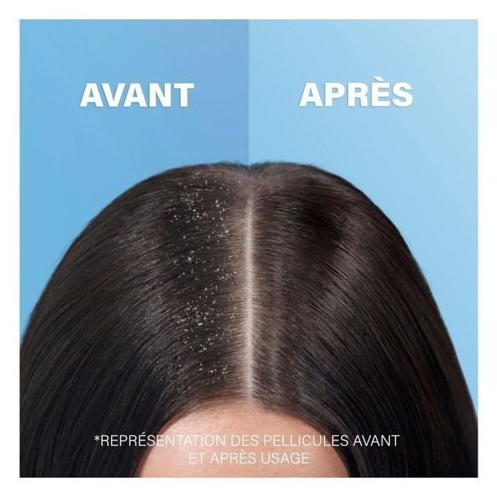 Shampoing Head & Shoulders Cheveux gras Anti-Démangeaisons 2-en-1 480