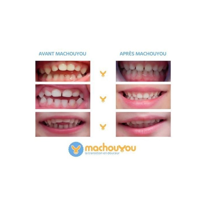 Machouyou Dispositif 1eres dents couleur - Orange
